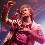 The Flaming Lips en vivo